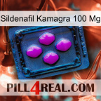 Sildenafil Kamagra 100Mg 04